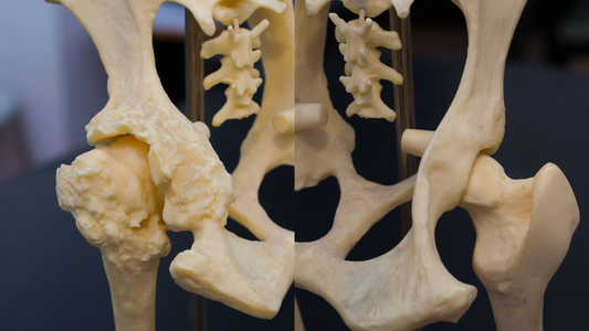 Hip Problems in Dogs: Understanding Hip Dysplasia